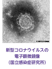 新型コロナウイルスの電子顕微鏡像（国立感染症研究所）